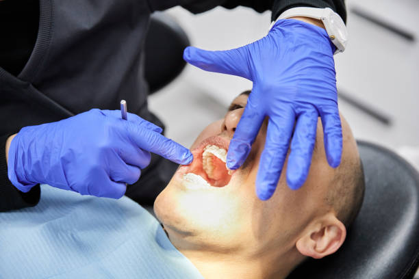 Best Emergency Dental Care for Broken or Chipped Teeth in Gretna, LA