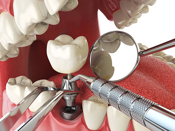 Best Urgent Care for Lost Fillings or Crowns in Gretna, LA